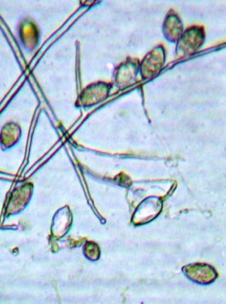 Mana tomatelor la microscop